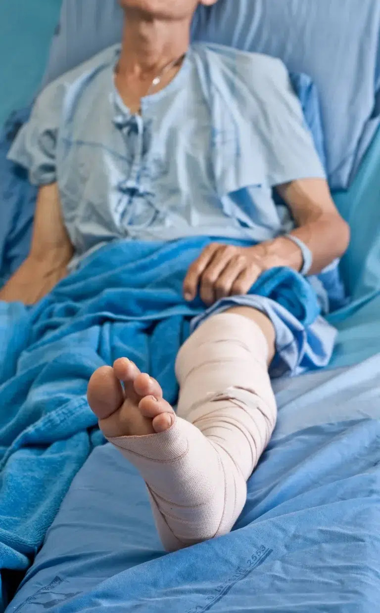 A person lying in a hospital bed wearing a gown, with their leg wrapped in bandages and elevated, suggesting an injury or surgery.