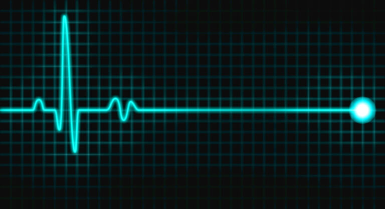 A blue electrocardiogram line shows a heartbeat spike followed by a flatline on a black grid background, ending with a glowing circle on the right.