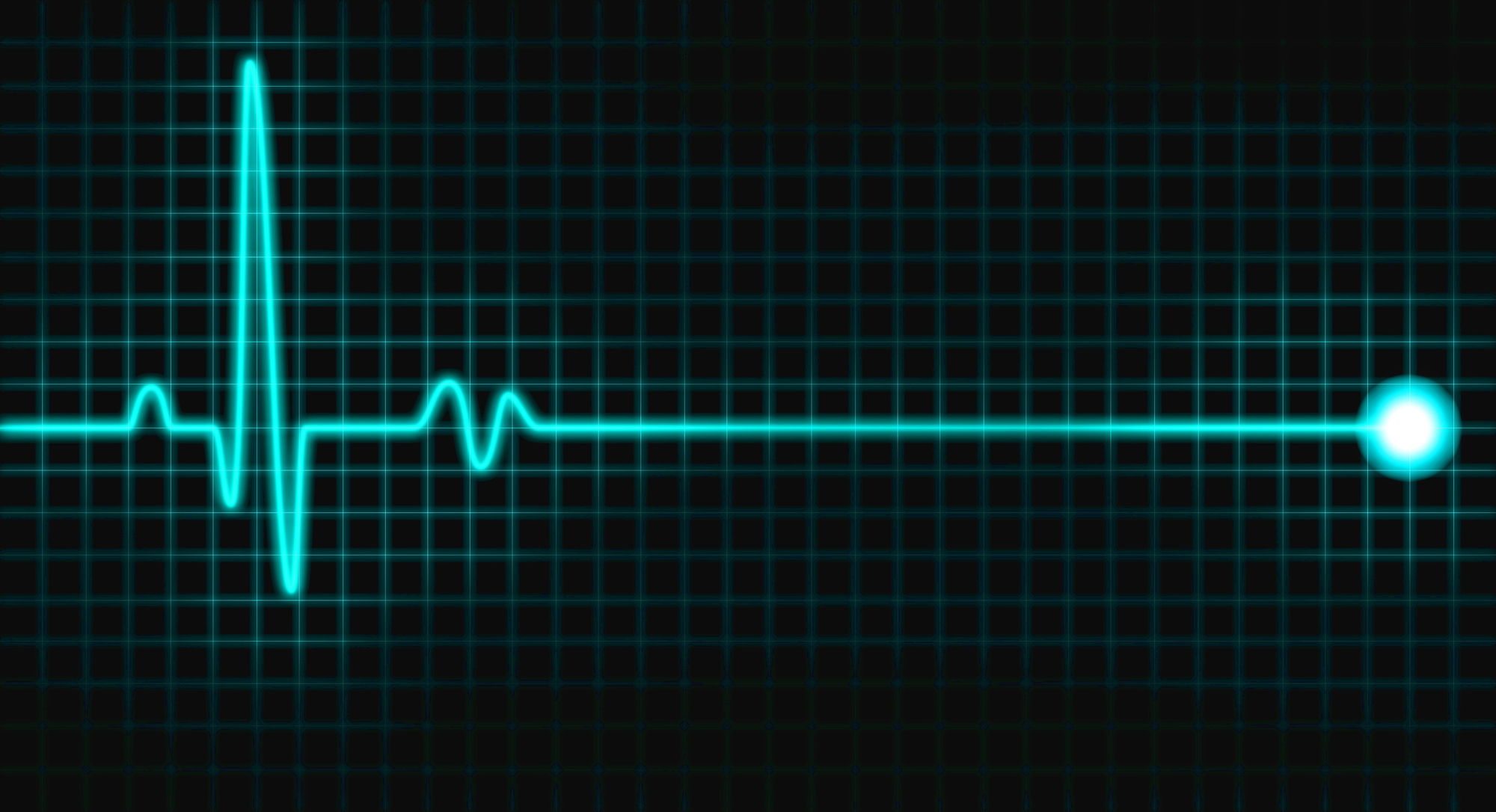 A blue electrocardiogram line shows a heartbeat spike followed by a flatline on a black grid background, ending with a glowing circle on the right.